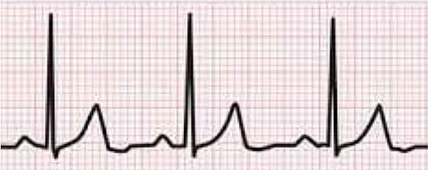 19th Doctors Office – Misdiagnosed as “Panic Attack”