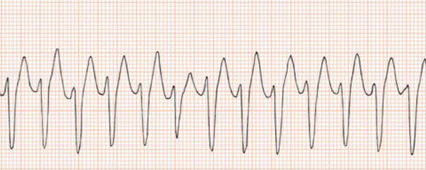 Hospital Stay: Six Days of Uncertainty